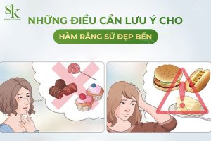 Những điều cần lưu ý cho hàm răng sứ bền đẹp