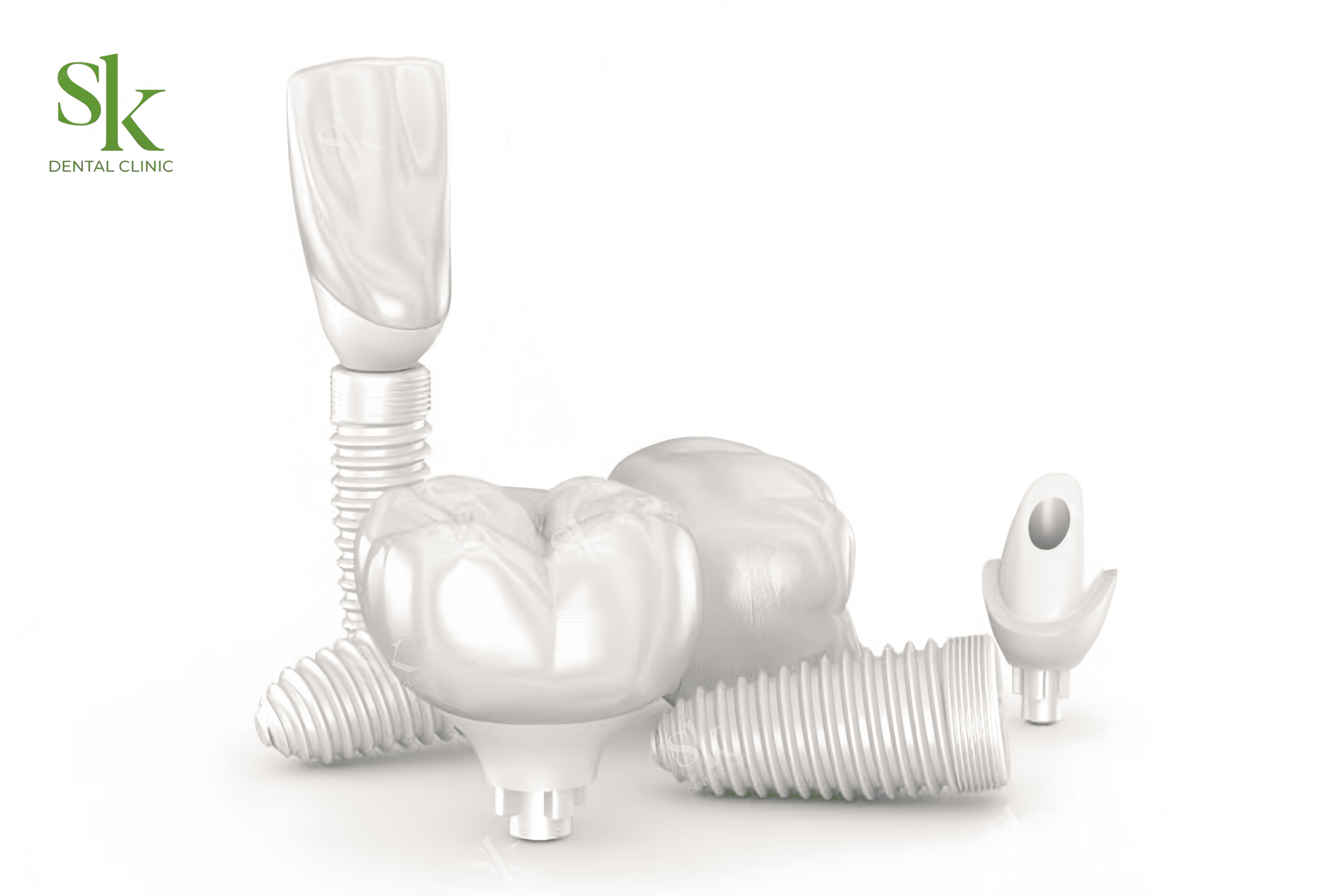 Abutment cá nhân hóa Zirconia với thẩm mỹ cao