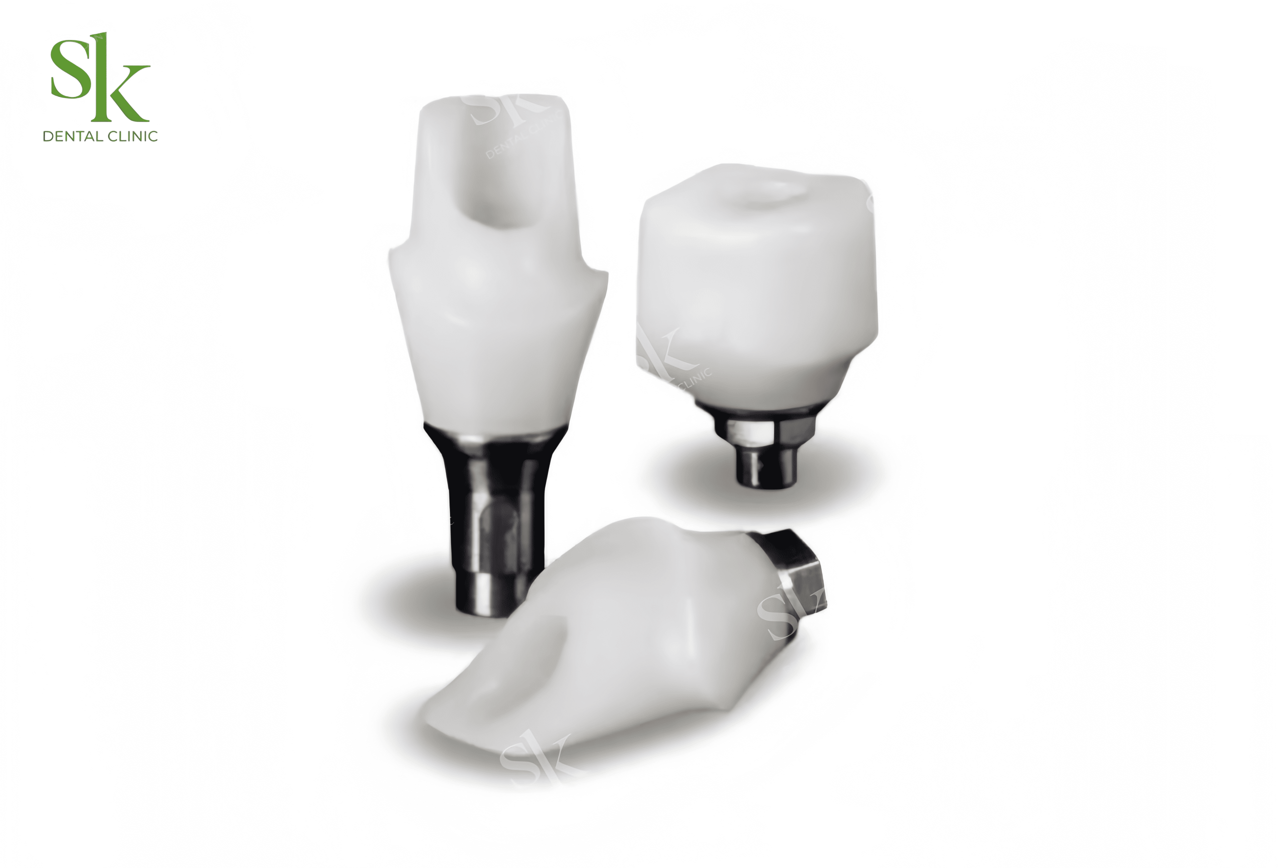 Abutment cá nhân hóa lai hybrid