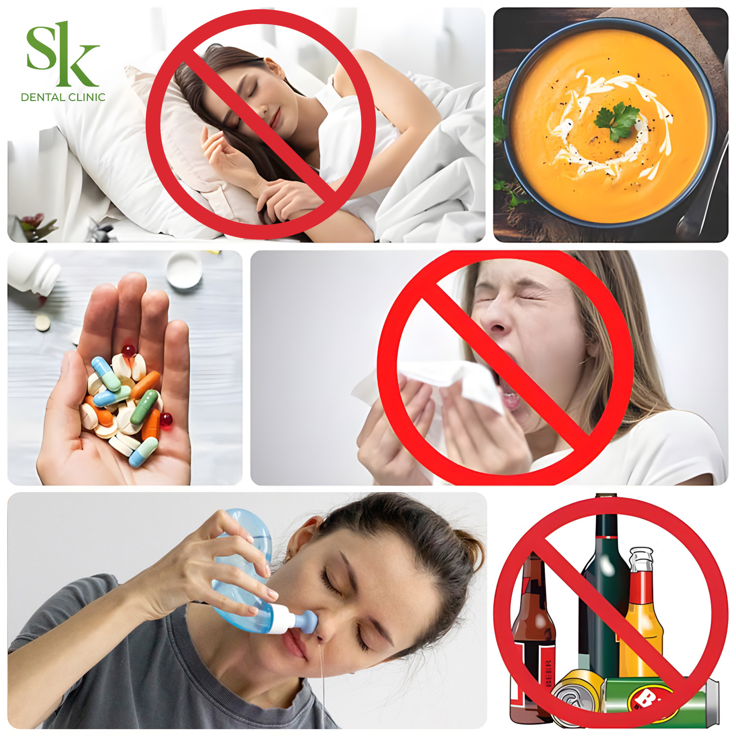 Cách chăm sóc sau khi nâng xoang