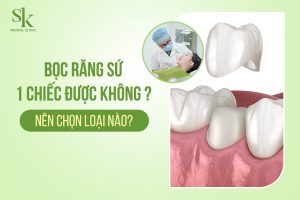 Chi phí Bọc răng sứ 1 cái