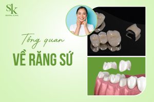 Tổng quan Răng sứ