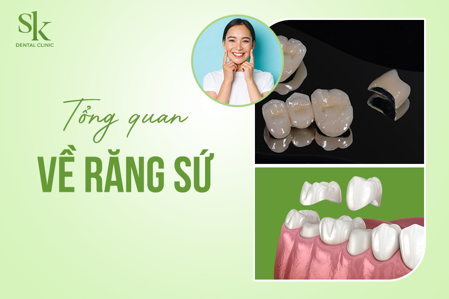 Tổng quan Răng sứ