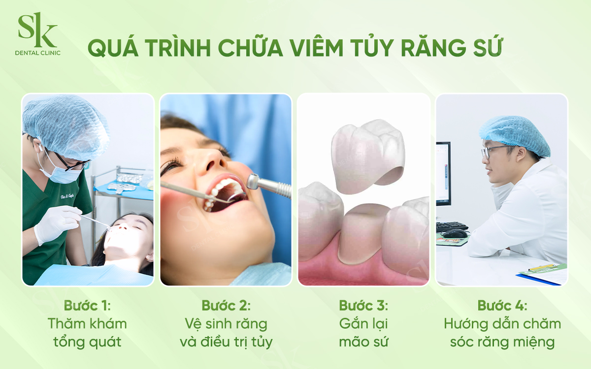 Quy trình chữa tủy răng đã bọc sứ triệt để
