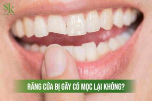 Răng cửa bị gãy có mọc lại không