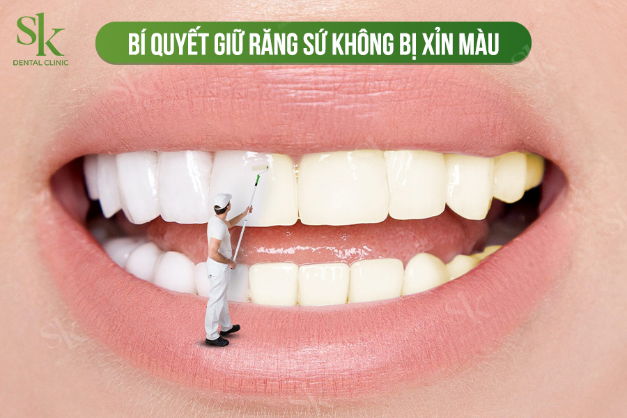 giữ răng sứ không bị xỉn màu