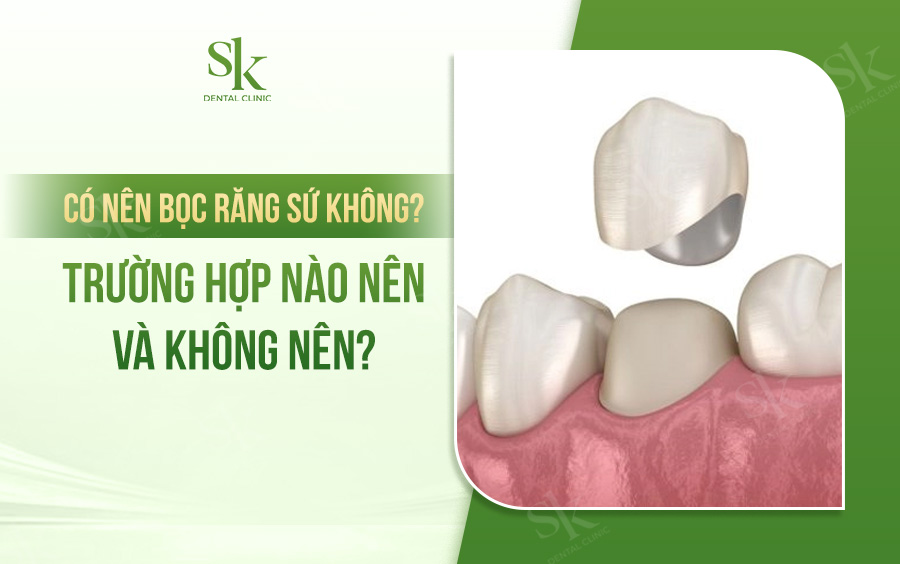 Có nên bọc sứ không?