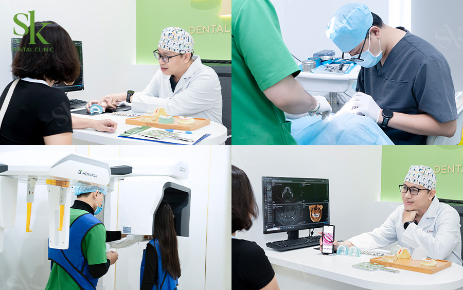 Lời khuyên từ bác sĩ: Có nên bọc răng sứ không?