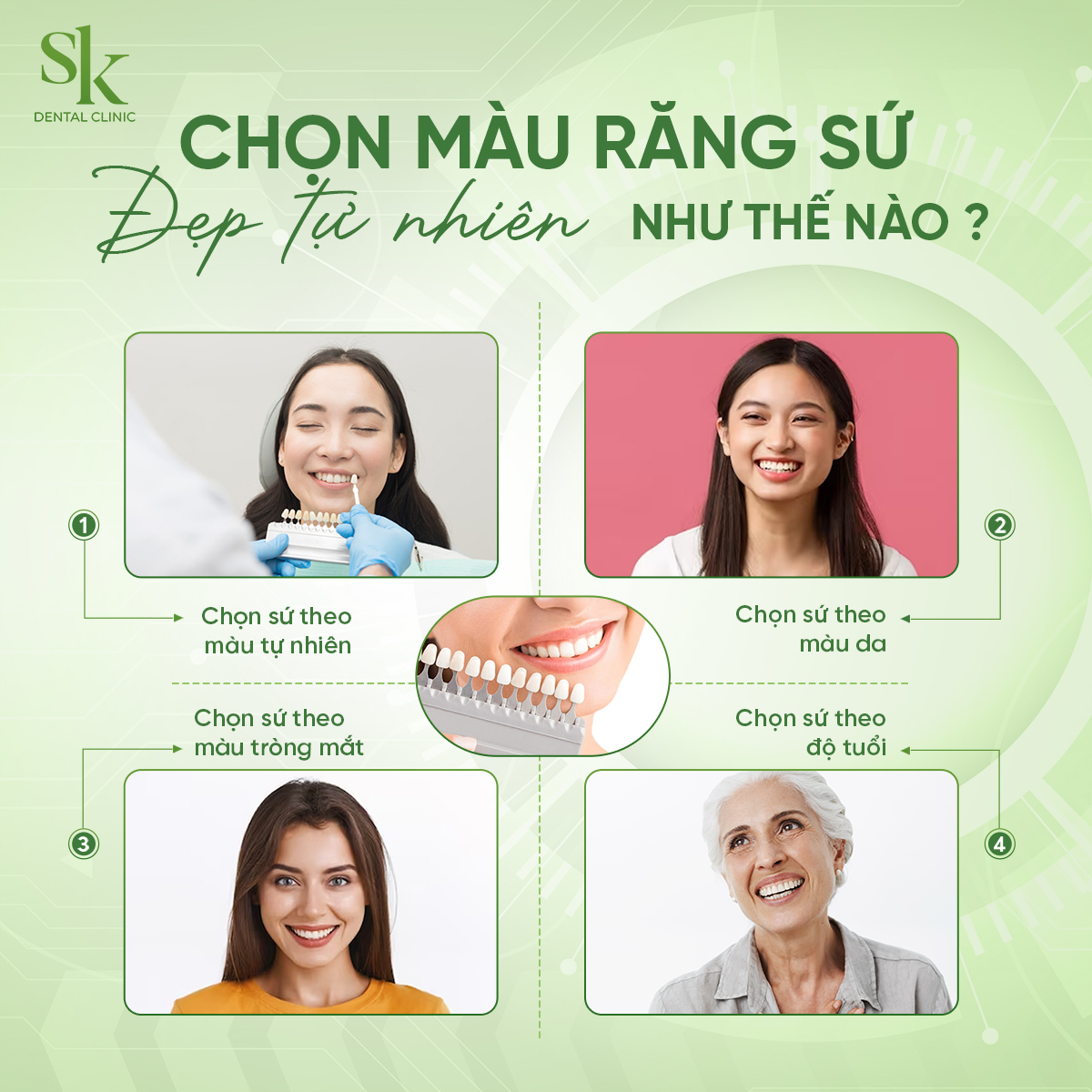 Cách chọn màu răng sứ đẹp tự nhiên