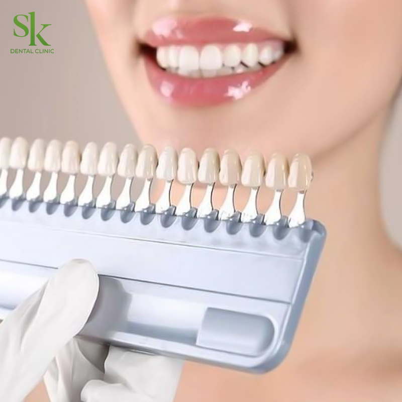 Quy trình lựa chọn màu răng sứ tại nha khoa SK Dental