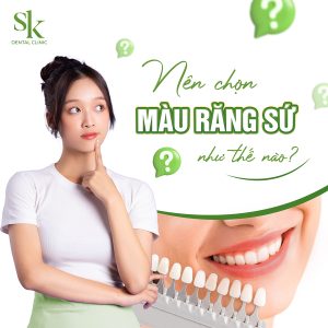 Nên chọn màu răng sứ như thế nào?
