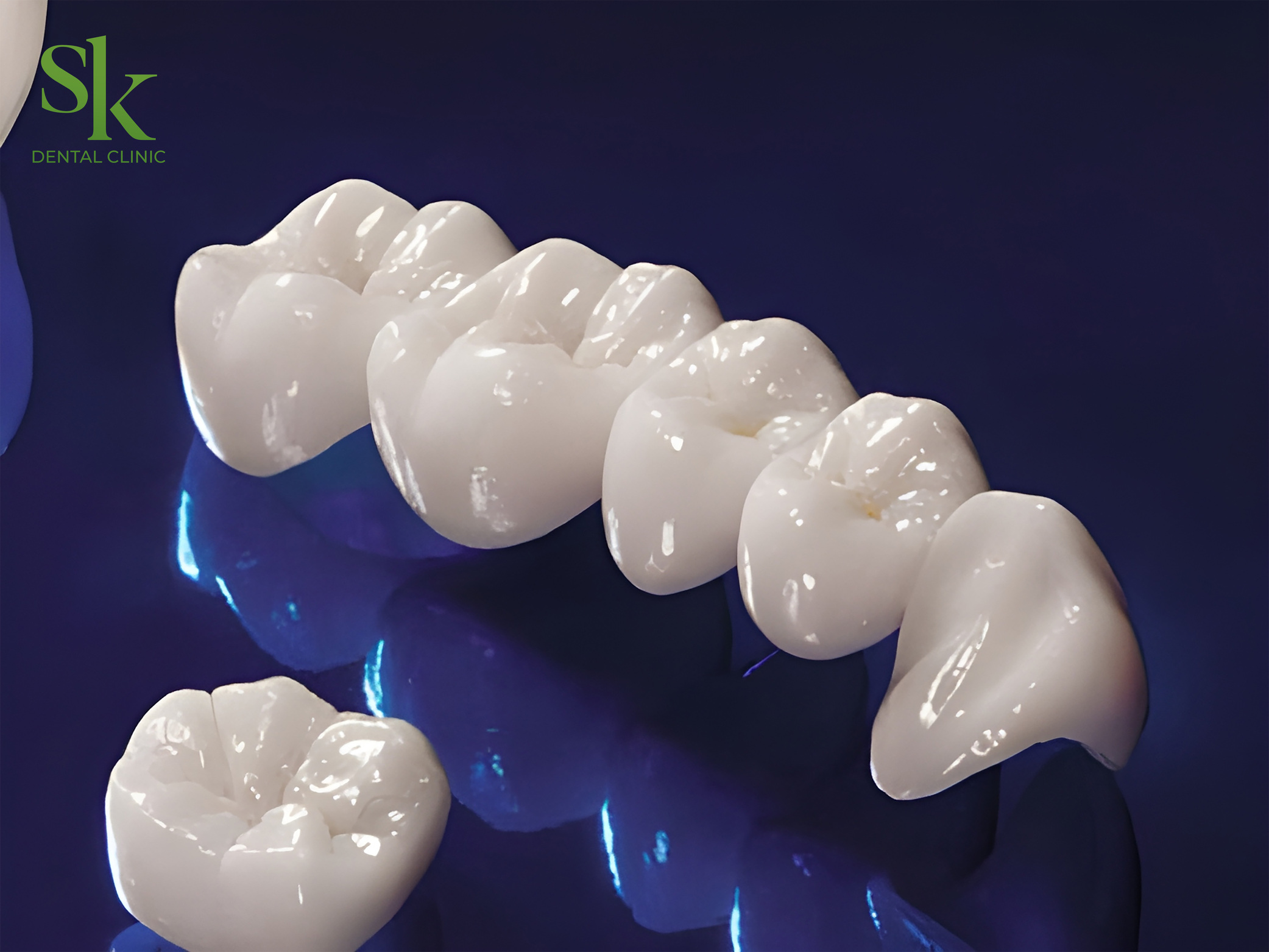 Dấu Hiệu Nhận Biết Răng Sứ Cần Thay Mới