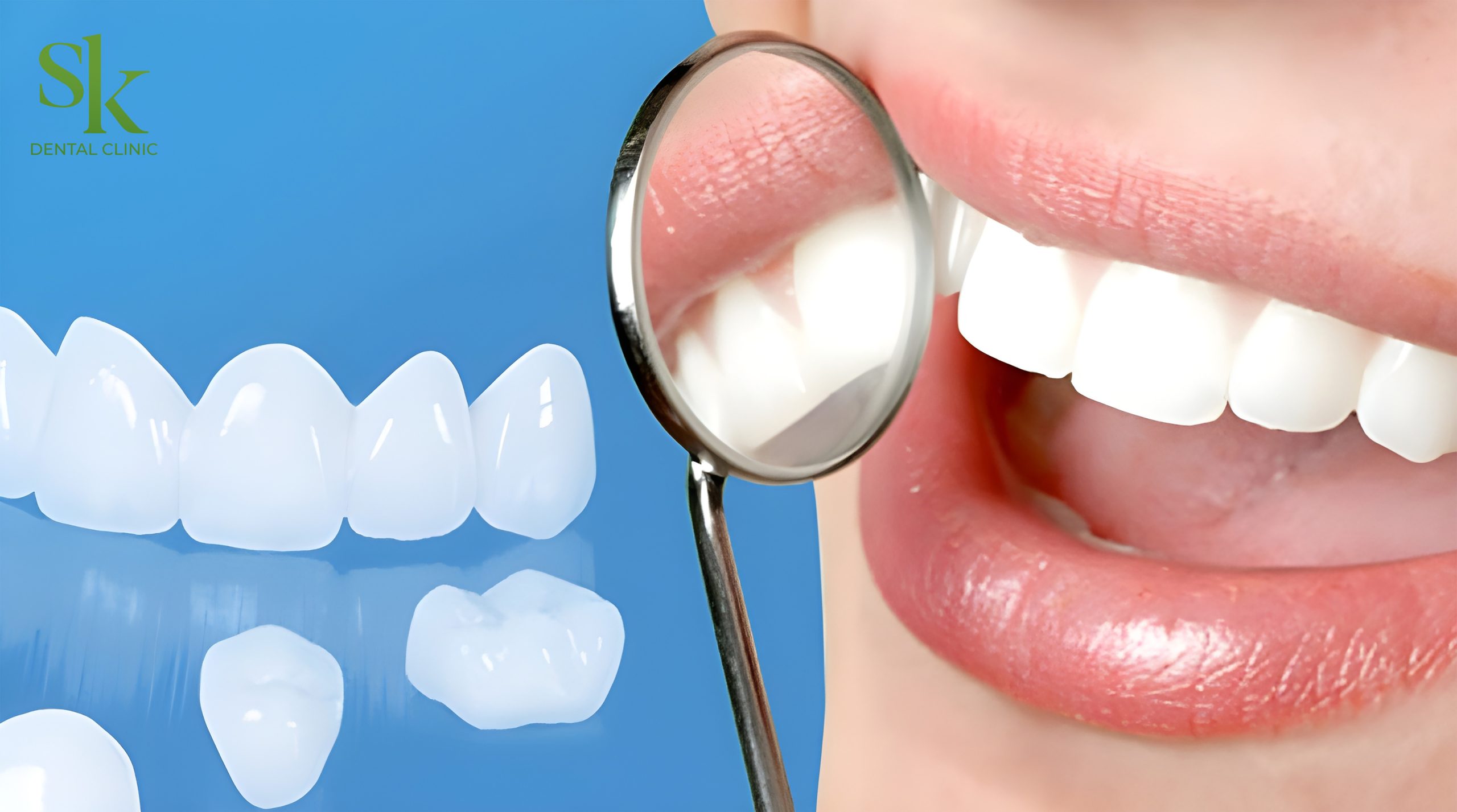 Cách Giúp Răng Sứ Bền Và Dùng Lâu Nhất