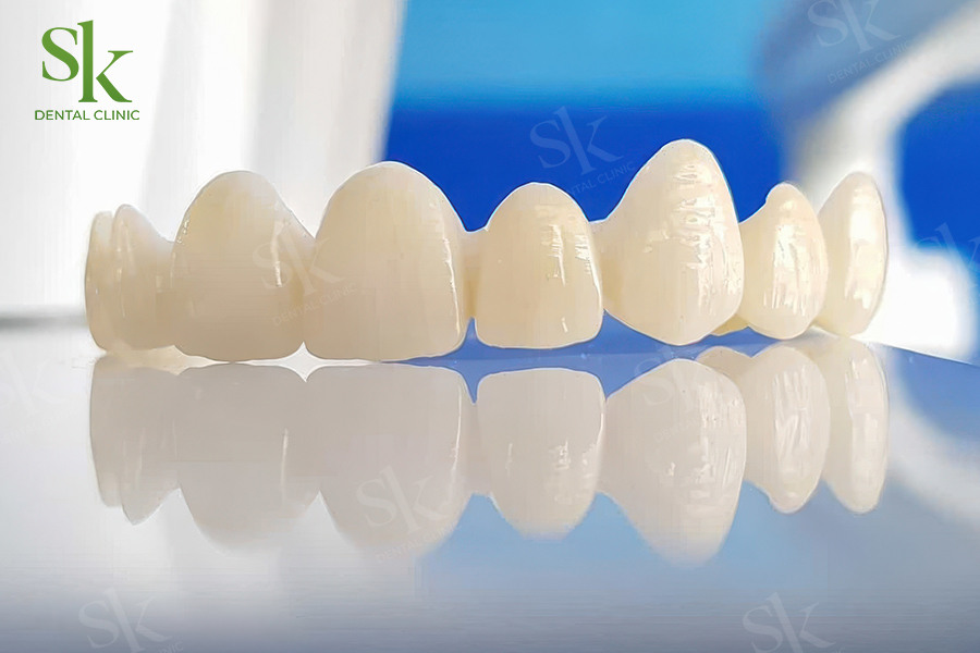 Răng toàn sứ