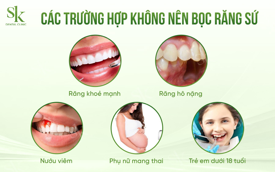 trường hợp không nên bọc sứ
