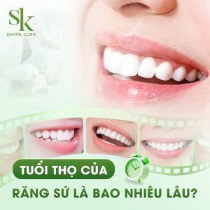 Tuổi thọ răng sứ bao lâu?