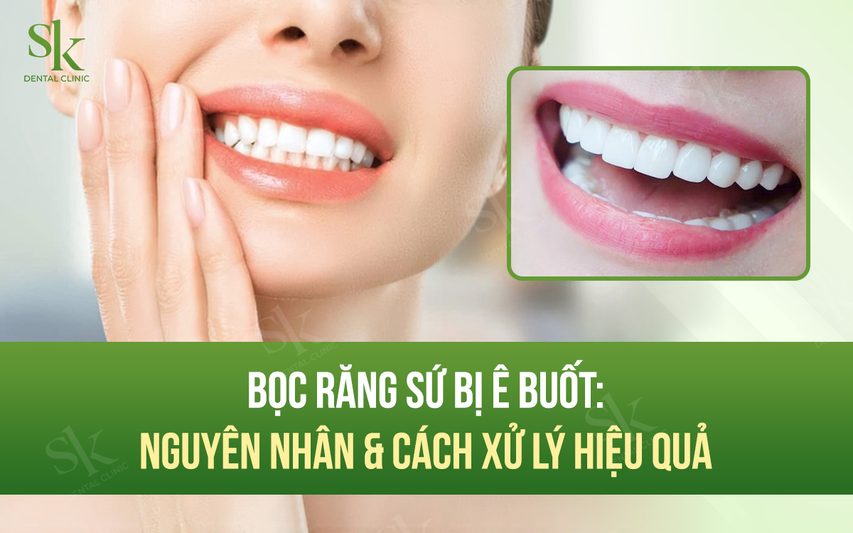 Bọc răng sứ bị ê buốt