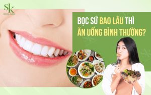 Bọc sứ bao lâu thì ăn uống bình thường