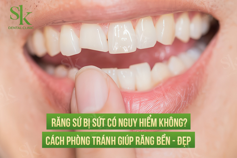 RĂNG SỨ BỊ SỨT mẻ