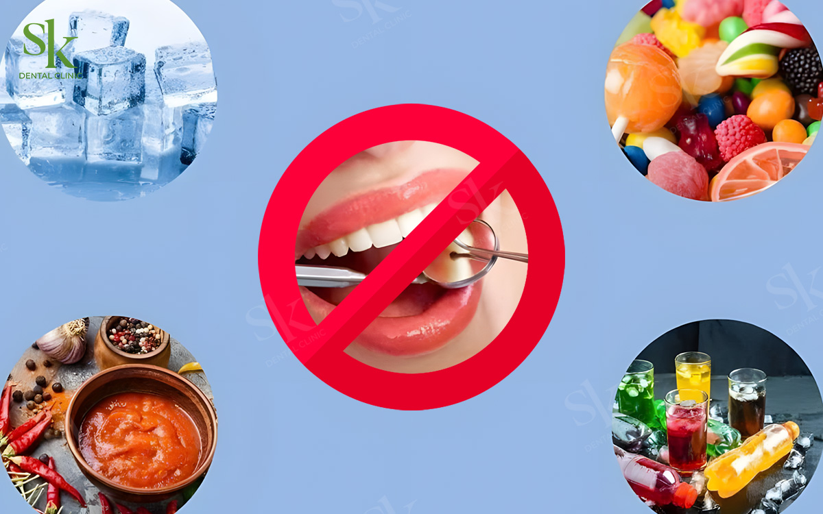 Những điều nên tránh khi bọc sứ