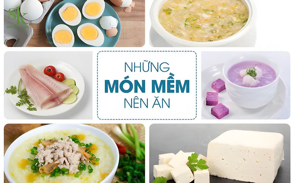 Những món nên ăn sau khi bọc răng sứ