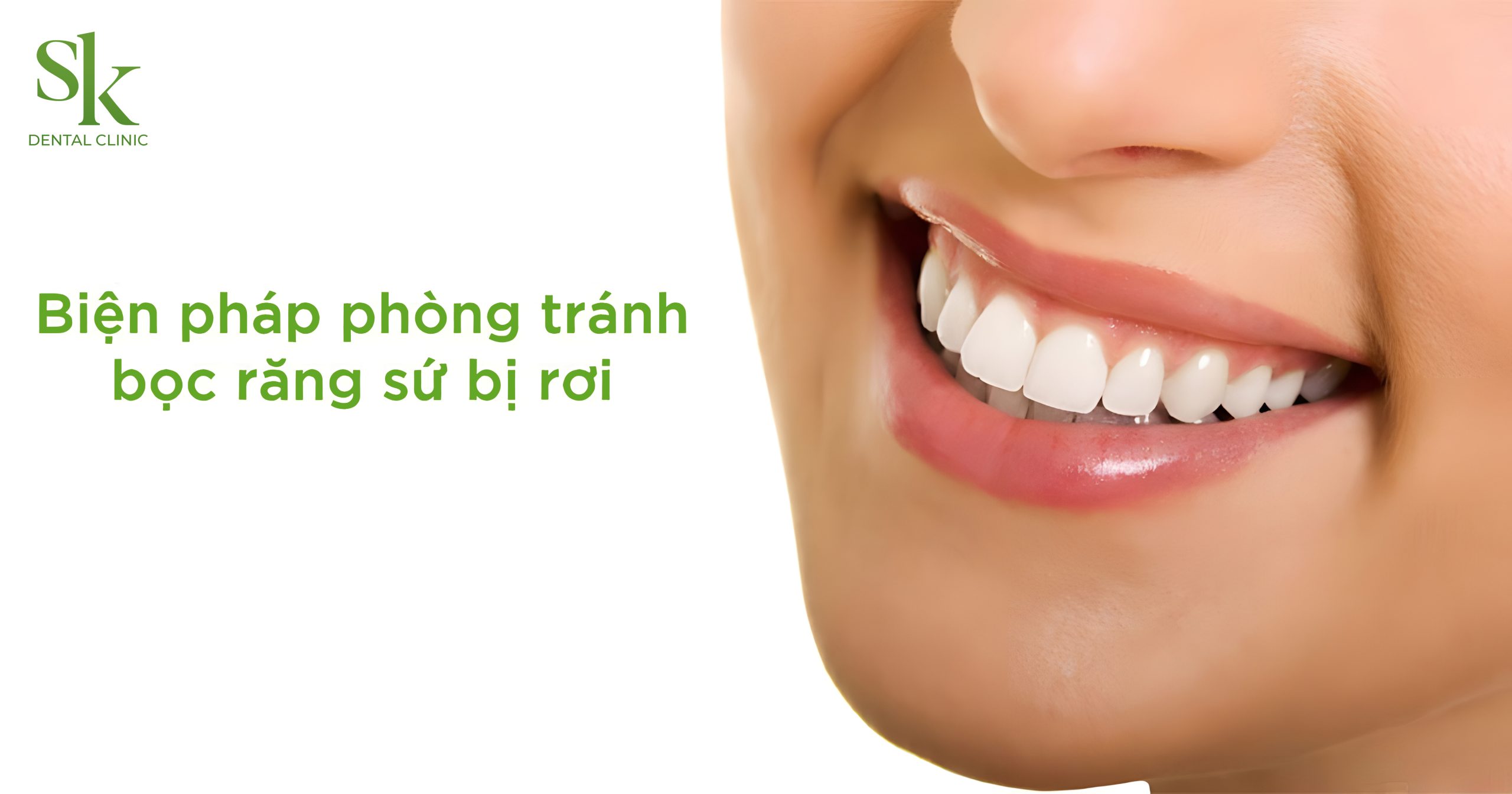 Phòng tránh bọc sứ bị rơi