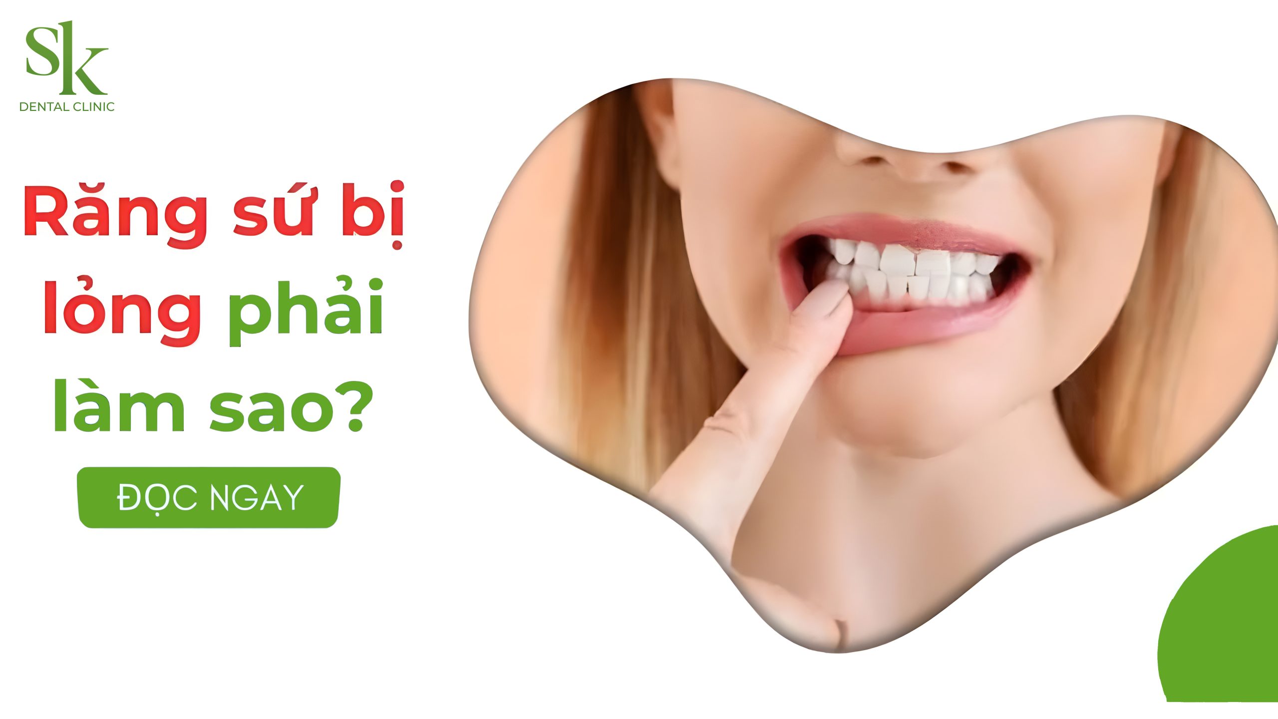 Răng bọc sứ bị lỏng phải làm sao?