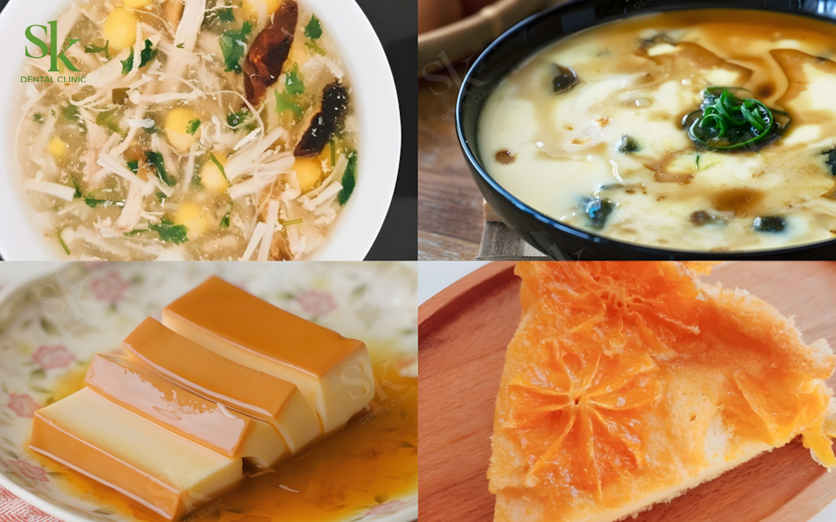 Nhóm thực phẩm nên ăn khi niềng răng