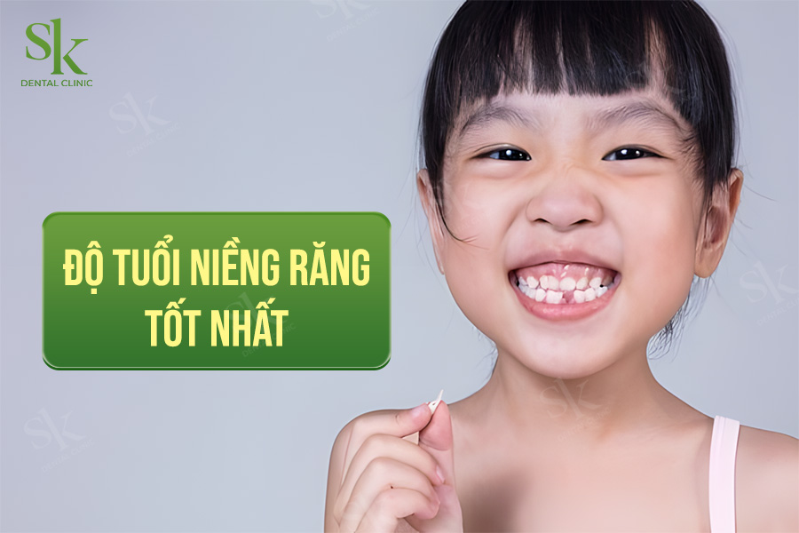 Độ tuổi nào để niềng răng tốt nhất?