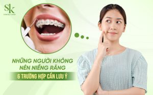 Những người không nên niềng răng