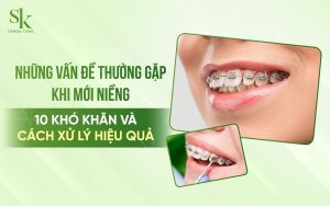 Vấn đề khi mới niềng răng