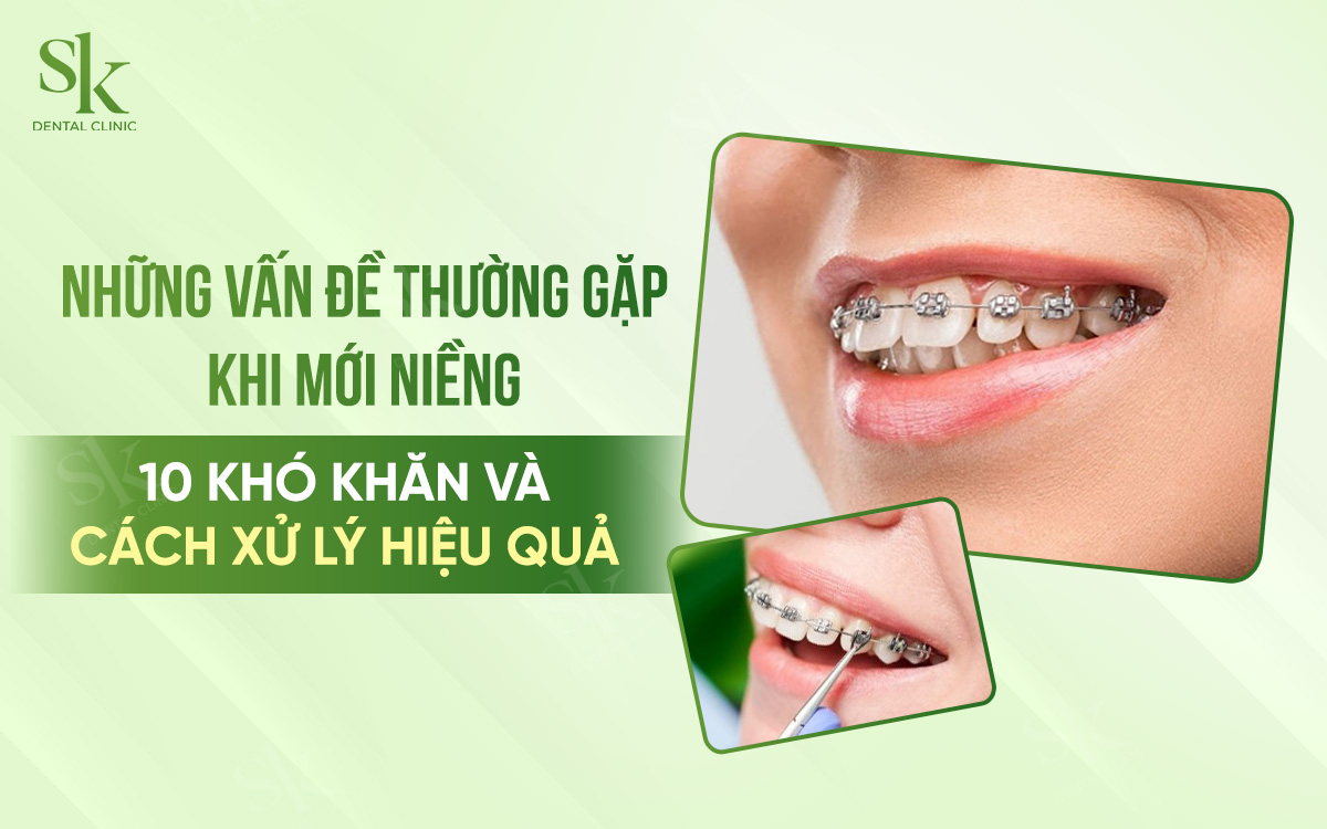 Vấn đề khi mới niềng răng