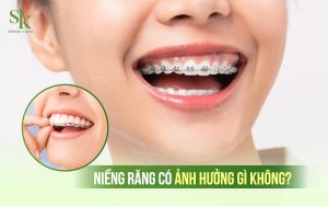 Niềng răng có ảnh hưởng gì không?