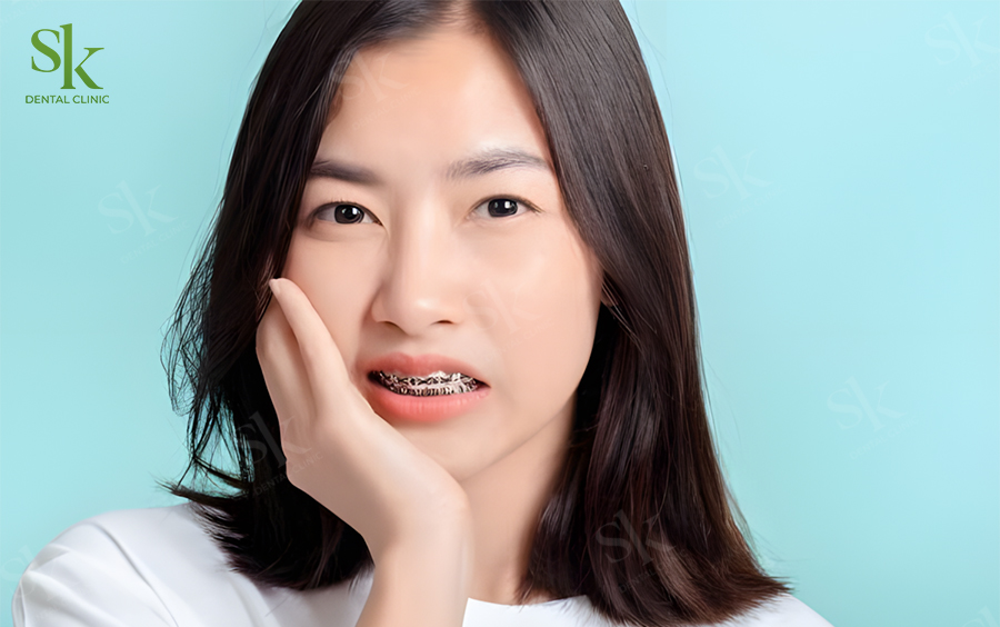 Niềng răng bị đau