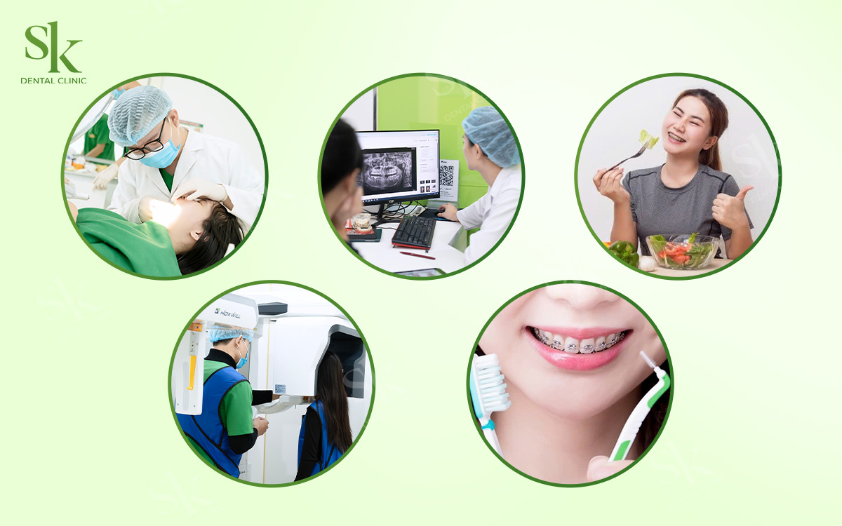 Cách hạn chế ảnh hưởng khi niềng răng