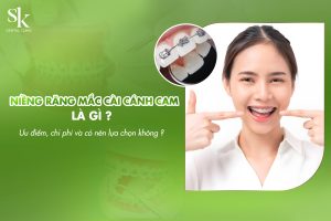 Niềng răng mắc cài cánh cam là gì