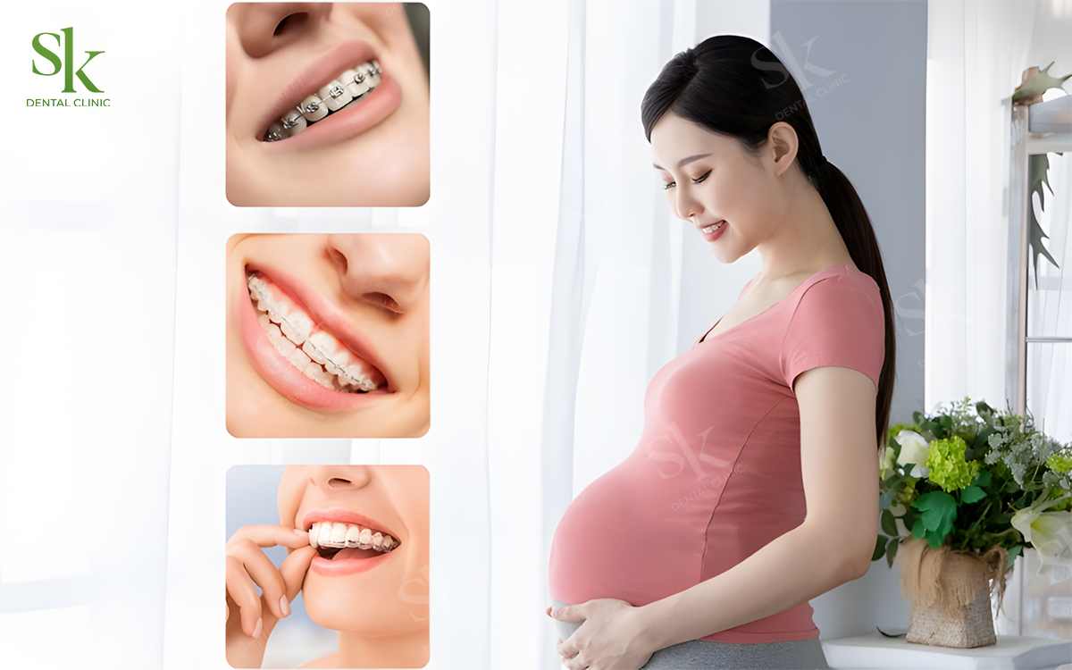 Phụ nữ đang mang thai hoặc cho con bú không nên niềng răng