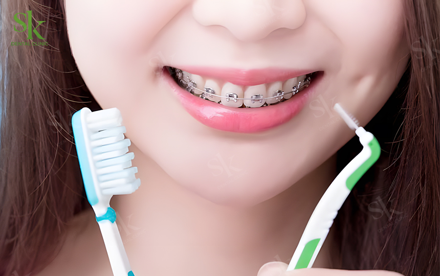 Duy trì vệ sinh răng miệng đúng cách để không viêm lợi