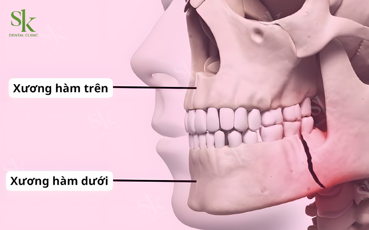 Cấu trúc xương hàm